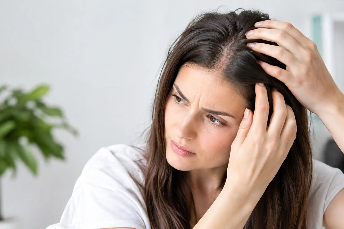 Caso de dermatitis capilar: qué hacer y evitar