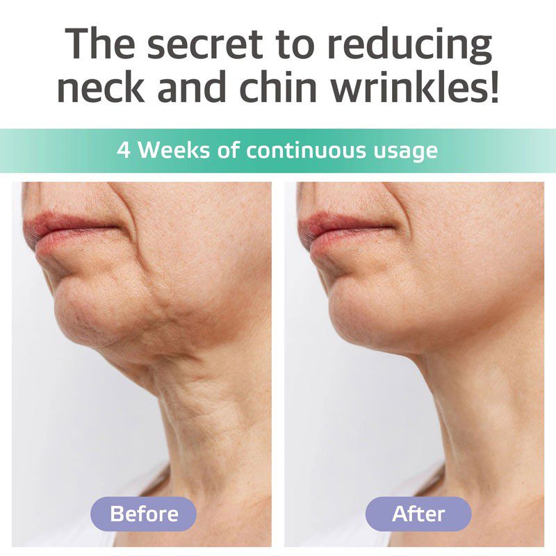 Parches Para Estilizar la Papada, Neck & Care patch
